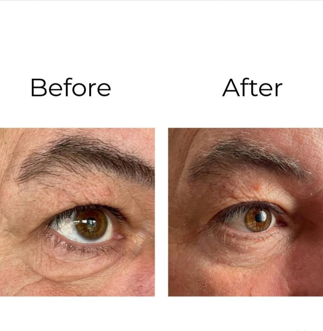 Peptilux - Crema contorno de ojos antiarrugas 'efecto shock action' con LIPHASYN