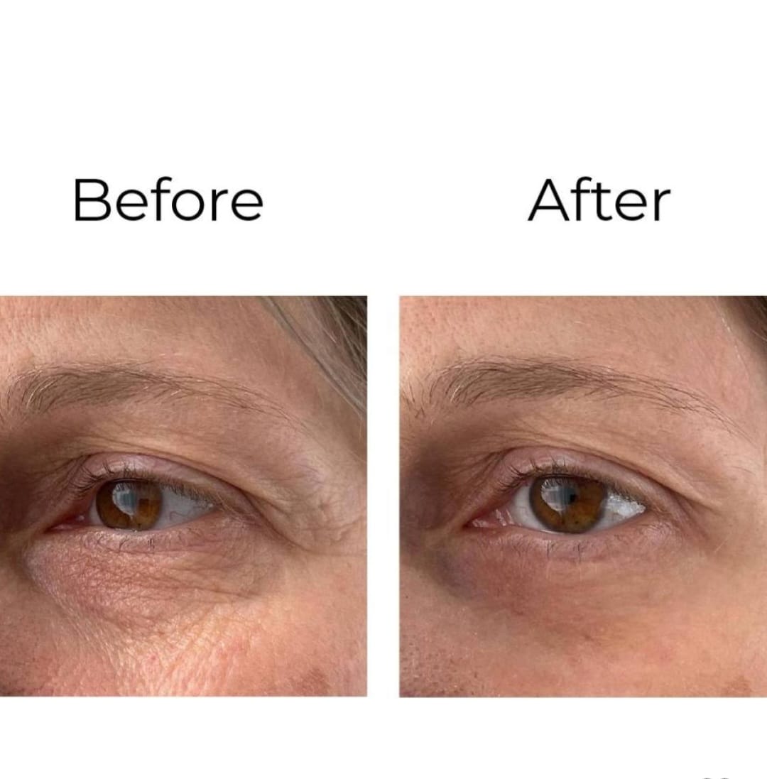 Peptilux - Crema contorno de ojos antiarrugas 'efecto shock action' con LIPHASYN