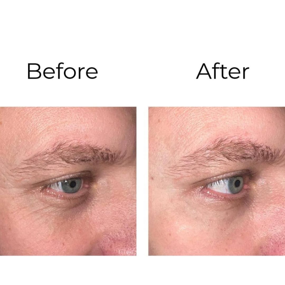 Peptilux - Crema contorno de ojos antiarrugas 'efecto shock action' con LIPHASYN
